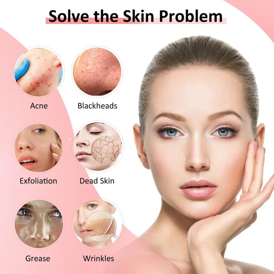 Ultrasonic Skin Scrubber, Cavitation Vibration Peeling Massager, Acne Blackhead Remover, Deep Clean Beauty Instrument Device, Acne Exfoliating Peeling Spatula, Deep Face Cleaning Pore Cleaner Tool, Exfoliation Grease Blackhead Extractor Lifting Device Ultrasonic Skin Scrubber, Cavitation Vibration Peeling Massager, Acne Blackhead Remover, Deep Clean Beauty Instrument Device, Acne Exfoliating Peeling Spatula, Deep Face Cleaning Pore Cleaner Tool, Exfoliation Grease Blackhead Extractor Lifting Device